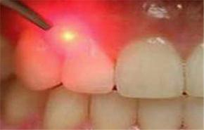 إيران الأولى في مؤتمر دولي لطب الأسنان