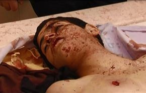 استشهاد فتى فلسطيني من عرب رام الله