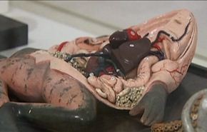 موزه وسائل کمک آموزشی پزشکی در سیدنی