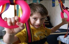 علاج الشلل الدماغي لدى الاطفال ومرض الأصابع الملتصقة