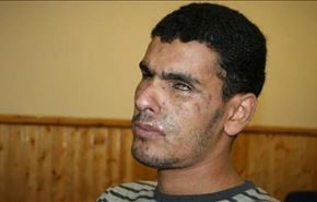 شکنجه جوان نابینای بحرینی در زندان