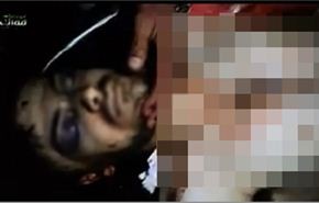 سرقة أعضاء شاب سوري بمستشفى حكومي تركي!