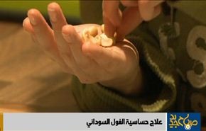 علاجات حديثة للحساسية من الفول السوداني