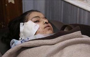 مقتل مدنيين بقصف الجماعات المسلحة في حلب