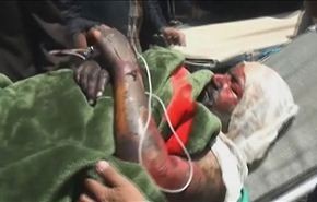 شاهد.. ماذا تفعل حمم الطيران السعودي بالمدنيين العزل؟