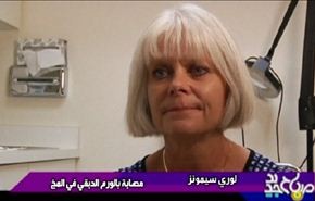 علاجات جديدة لمرض السرطان في الولايات المتحدة