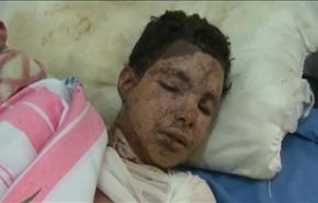 الائتلاف المدني يؤكد ارتفاع شهداء الحرب على اليمن لـ1300