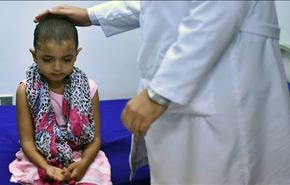 كاميرا العالم في إحدى مراكز إيواء النازحين اليمنيين