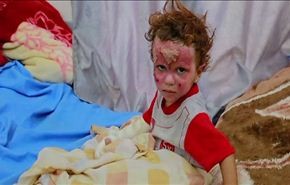 نساء واطفال ضحايا غارات سعودية بعدة مناطق في اليمن