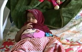 مركز صنعاء لعلاج الأورام.. معاناة مأساوية بفعل العدوان والحصار