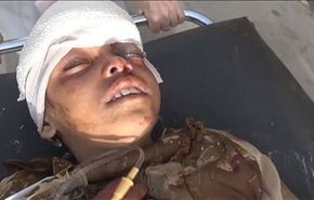 ابادة جماعية بتوقيع سعودي في حي سكني بصنعاء في ايام الهدنة!