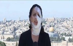الاحتلال يصيب مراسلة اثناء تغطيتها اقتحام منزل الشهيد علون