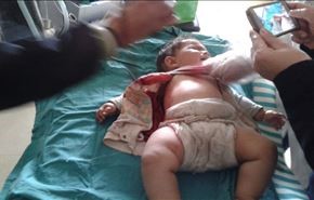 صورة..اصابة رضيعة في الفوعة برصاص أحد المسلحين