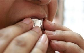صور:ماذا يحدث لأسنانكم إذا وضعتم عليها رقائق الألمنيوم لساعة واحدة!