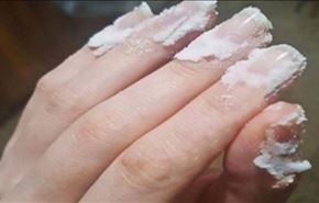 افركوا البيكنغ صودا على أظافركم.. ولاحظوا ما سيحدث!