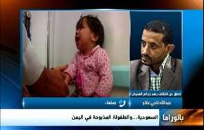 تطورات الموصل ووادي بردى والوضع الانساني باليمن