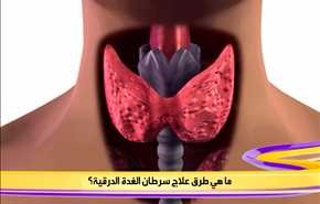 ما هي طرق علاج سرطان الغدة الدرقية؟