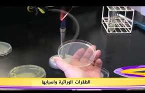 الطفرات الوراثية واسبابها