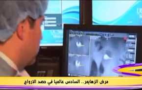 مرض الزهايمر.. السادس عالميا في حصد الارواح