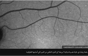 اختبار للعين 