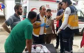 بالصور.. ولادة طفل برأسين في إدلب!