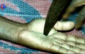 بالصور.. ساحرة تدعي علاج المرضى بـ