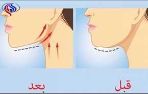 تخلص من الذقن المزدوج بهذه المادة السحرية الفعالة!