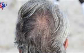 هل انتزاع الشعر الأبيض يؤدي إلى انتشاره؟