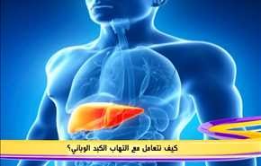 كيف  نتعامل مع التهاب الكبد الوبائي؟