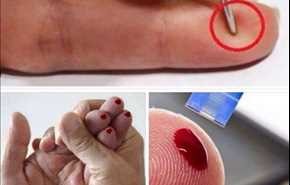 هكذا يمكنك إنقاذ إنسان من السكتة الدماغية !!