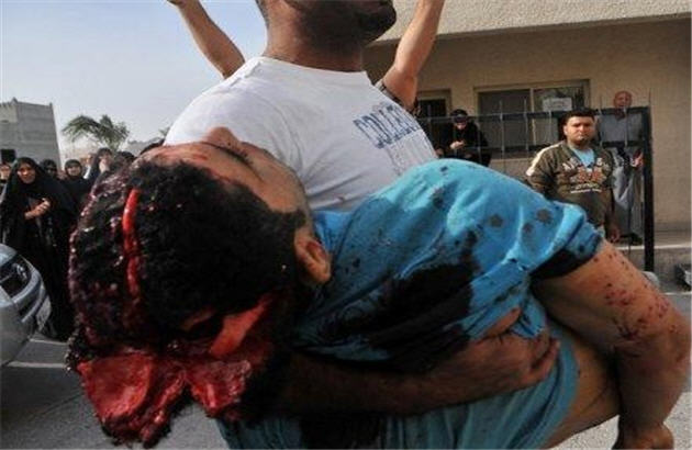 گزارش پزشکان سند جنايات آل خليفه