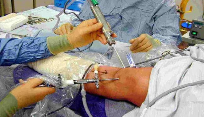 دراسة: جراحة الركبة تقلل مستوى اداء الرياضيين