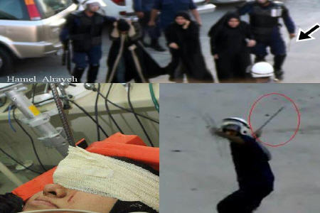 شکافته شدن سر زن بحرینی با آرماتور