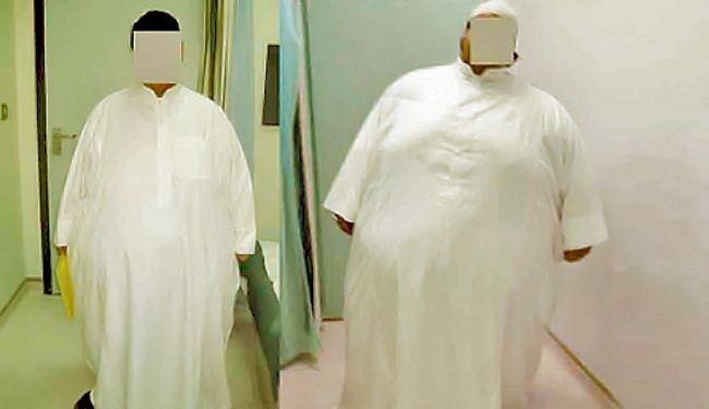 نصف السعوديين البالغين يعانون من السمنة