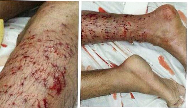 تیراندازی به بحرینی ها از فاصله 4 متری
