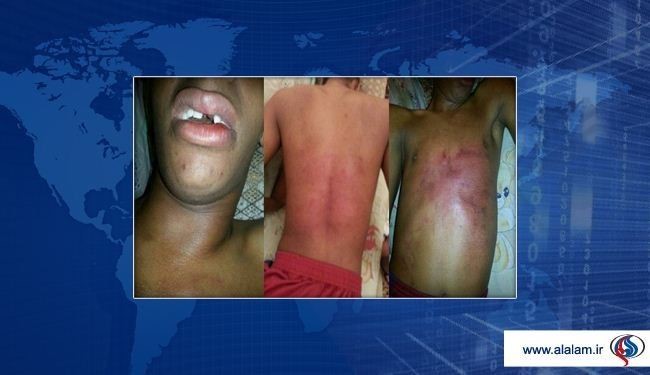 جزئیات ربایش وشکنجه جوان بحرینی به‌دست افسر نقابدار