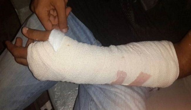 مرتزقة المنامة تعتدي على طفل وتتسبب بكسر في يده