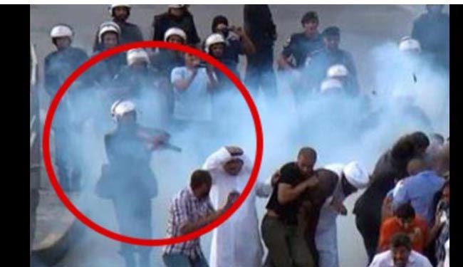 جوان مجروح بحرینی، مرگ مغزی شد