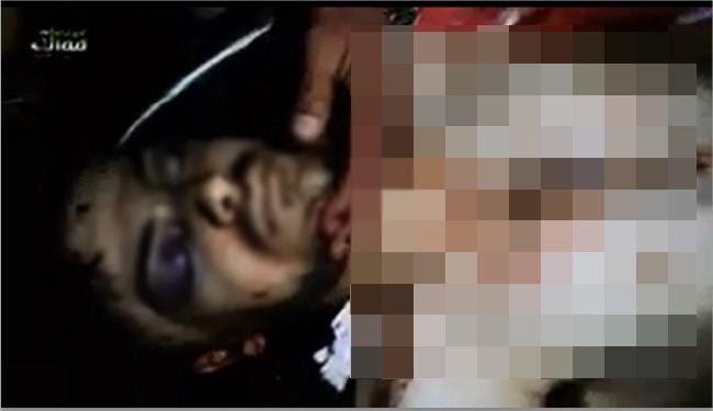 سرقة أعضاء شاب سوري بمستشفى حكومي تركي!