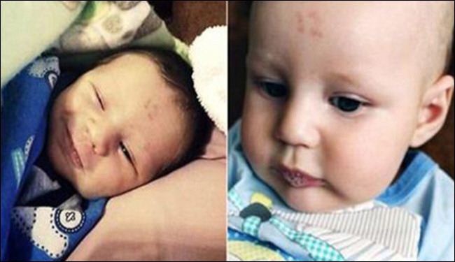 صور لطفل يحير الأطباء بعد ولادته وعلى جبينه رقم 12