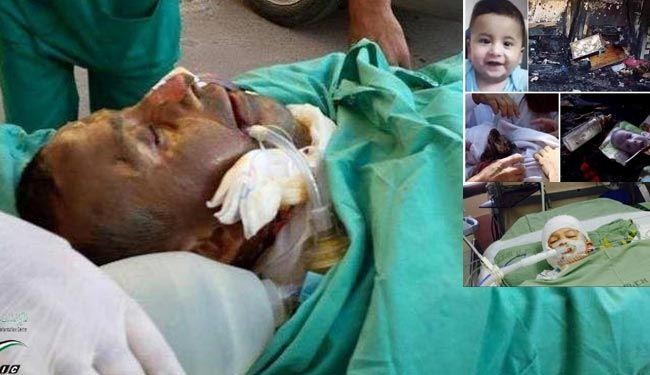 استشهاد والد الطفل الرضيع علي دوابشة متأثراً بجراحه حرقا