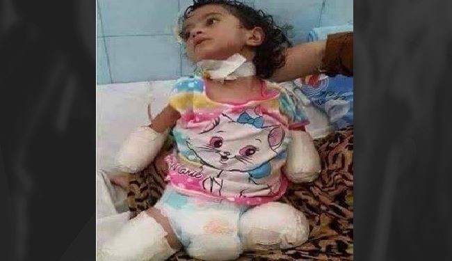 جرائم حرب وابادة يرتكبها العدوان السعودي في صنعاء