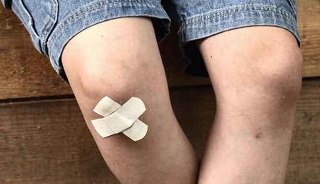 5 طرق مدهشة لعلاج الجروح بسرعة
