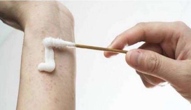 5 مكونات طبيعية لعلاج لدغ البعوض
