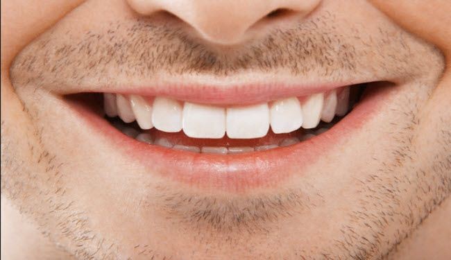 تخلص من آلام وتسوس الأسنان بهذه الطرق...