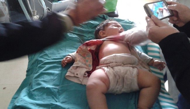 صورة..اصابة رضيعة في الفوعة برصاص أحد المسلحين