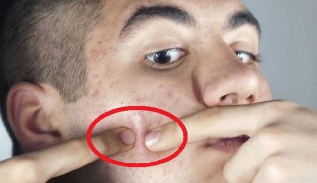 ما المضر أكثر.. إزالة البثور يدوياً أم تركها؟