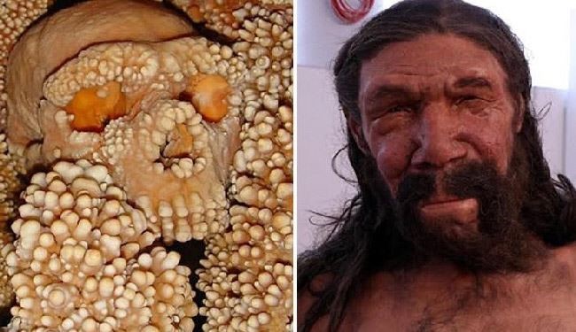 إعادة تشكيل وجه رجل عمره 150 ألف عام !