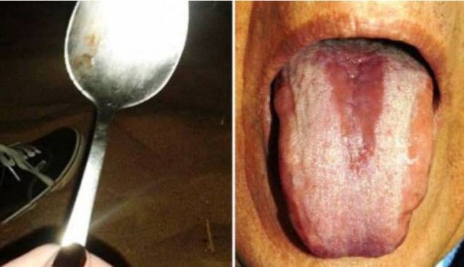 مفاجأة .. اختبار بسيط بواسطة ملعقة يحدد مرضكم !
