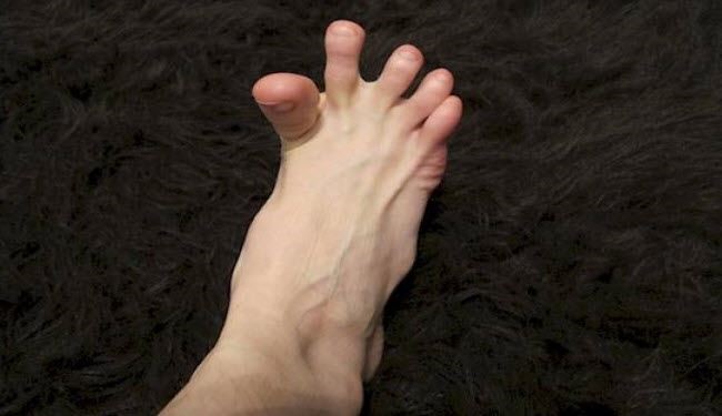 لهذا السبب تصابون بتشنجات مفاجئة في أقدامكم!